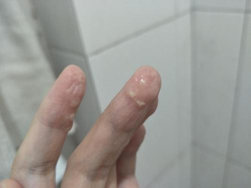 豆腐渣白帶是懷孕了嗎