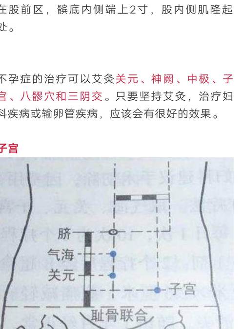 艾灸肚子會(huì)導(dǎo)致不孕嗎