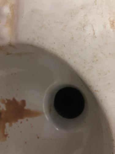 同房后出現(xiàn)豆腐渣咋回事